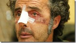 IMAGEN DEL HERIDO EN MURCIA